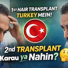 Hair Transplant in Kerala (HX-AWEU) | Best Results & Cost of Hair Transplant in Kerala