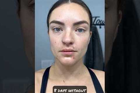 How my face changed with 8 days no alcohol #dryjanuary #sober #sobriety #shortsvideo #shorts
