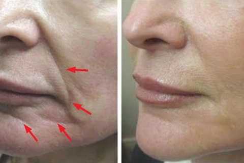 Just 2 skin tightening and face lifting home remedies