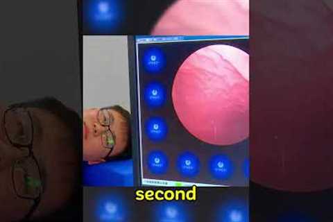China’s Genius Endoscopy Capsule Replaces Painful Tubes! 🤯 | Medical Innovation #technology
