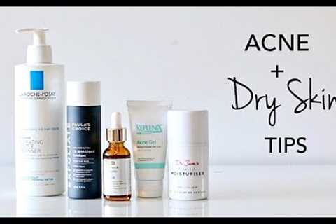 How To Treat Dry Skin + Acne