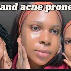Step by step routine for oily and acne prone skin: how I cleared my acne