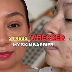 Stress is Destroying Your Skin Barrier (My Mistake)