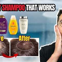 What is the Best Shampoo for Hair Loss? Doctor Reveals the Truth