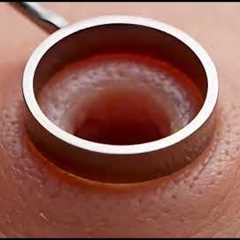 Satisfying Blackhead Removal Compilation | Deep Pore Cleaning ASMR Extreme Blackhead Extraction