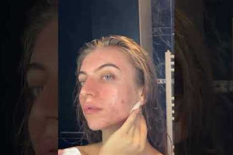 Realistic Skincare Routine For Acne Prone #acne #skincare