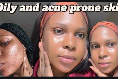 Step by step routine for oily and acne prone skin: how I cleared my acne