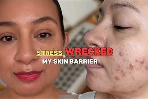 Stress is Destroying Your Skin Barrier (My Mistake)