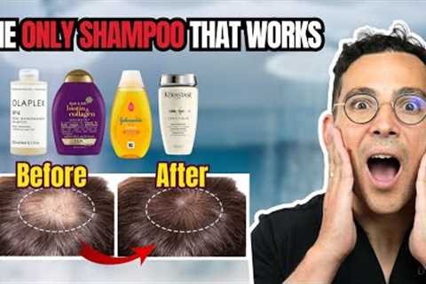 What is the Best Shampoo for Hair Loss? Doctor Reveals the Truth