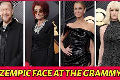 22 Celebrities With Shocking Grammys 2026 Transformations — Ozempic Face?