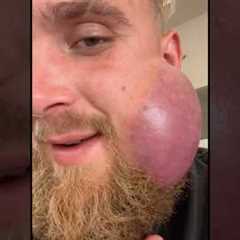 Jake Paul Jaw Getting Worse 😞 #jakepaul #viral #funny #boxing