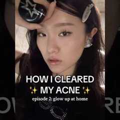 HOW I CLEARED MY ACNE AND SKIN AT HOME :) very requested vid #glowup #skincareroutine #glowuptips