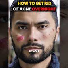 Get Rid of acne OVERNIGHT