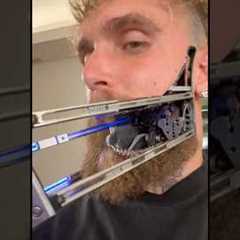Jake Paul Put New Robotic Jaw!? 😳 #jakepaul #funny #boxing #viral #breakingnews