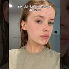 I tried a Korean skincare routine for 3 weeks heres the results so far✨see description 👇🏼😘🫶🏼