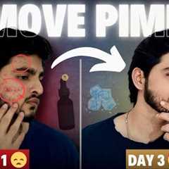Face Pimples Removal Naturally | 3 DIN ME PIMPLE GAYAB 😱| Acne Treatment at Home | Pimple Treatment