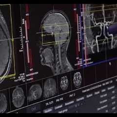 What We’ve Learned Treating 4,000 Patients With Long COVID-19