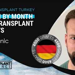 Month by Month #hairtransplant Time Lapse Before After Results #hairtransplantturkey #4500grafts