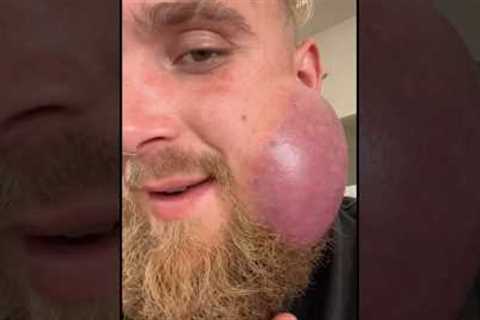 Jake Paul Jaw Getting Worse 😞 #jakepaul #viral #funny #boxing