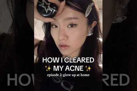 HOW I CLEARED MY ACNE AND SKIN AT HOME :) very requested vid #glowup #skincareroutine #glowuptips