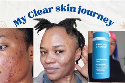 BEST ACNE skincare products... How I cleared up my pimples #clearskin #asmr