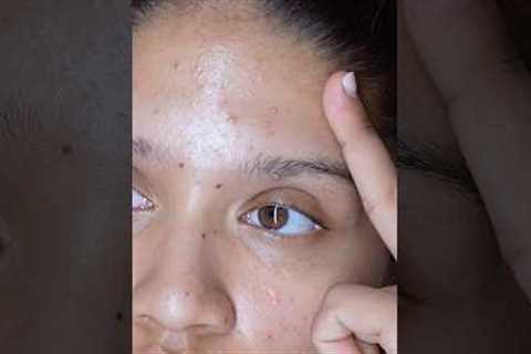 Night skincare routine for acne-prone skin when my skin is breaking out.