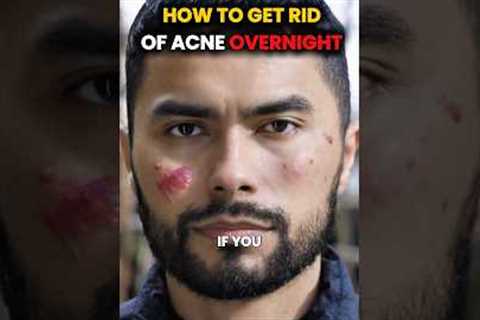 Get Rid of acne OVERNIGHT