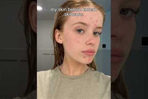 I tried a Korean skincare routine for 3 weeks heres the results so far✨see description 👇🏼😘🫶🏼