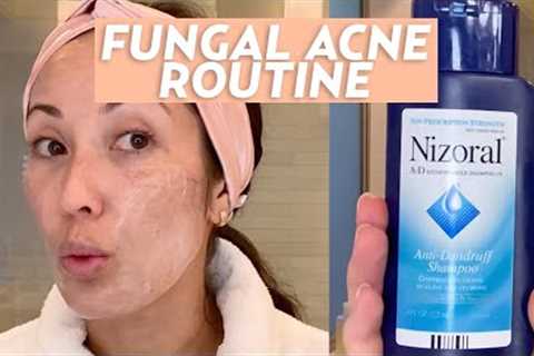 Treat Fungal Acne With This Skincare Routine | #SKINCARE