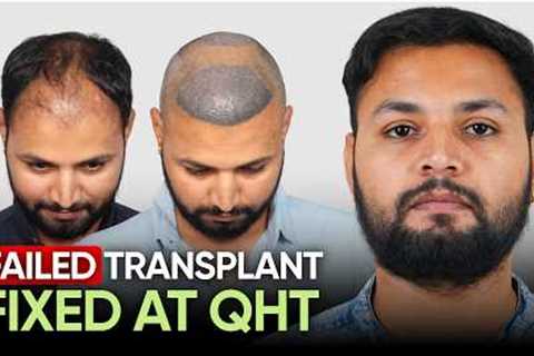 Hair Transplant in Mumbai (HX-QAGG) | Best Results & Cost of Hair Transplant in Mumbai.