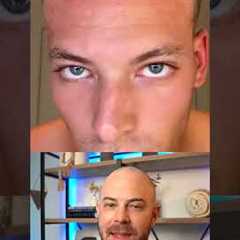 Doctor reacts to derma-rolling routine for hair growth! #hairloss #dermreacts #doctorreacts