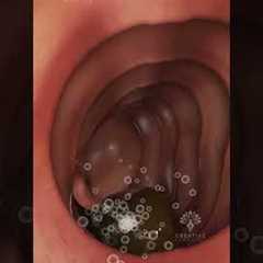 How Your Body Turns Food Into Poop: The Digestive Journey #shorts #viralvideo - creativelearning3d