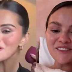 Selena Gomez ADDICTION To Fillers Is DESTROYING Her Face