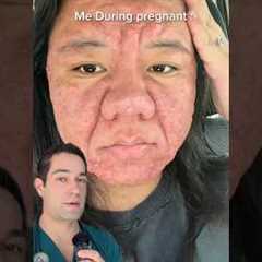 How pregnancy affects your looks