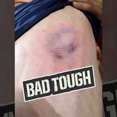 BEANED by 98 mph…TWICE IN ONE AT BAT?! 😱🤯