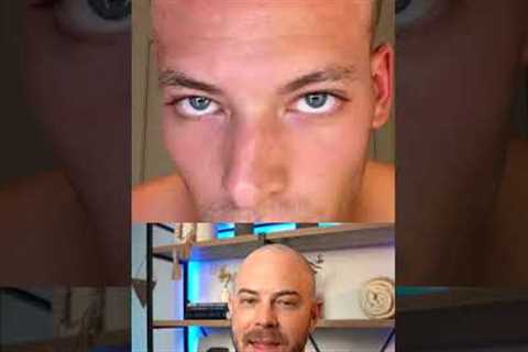 Doctor reacts to derma-rolling routine for hair growth! #hairloss #dermreacts #doctorreacts
