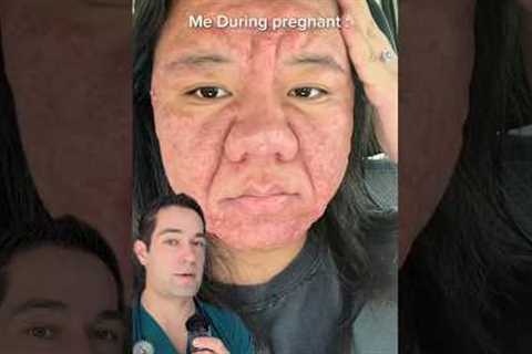 How pregnancy affects your looks