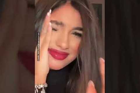 TikTok star viciously attacked and nearly blinded by her own CAT – leaves viewers terrified