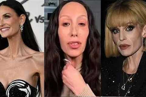 These Celebrity Ozempic Transformations Have Fans Seriously Concerned