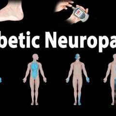 Diabetic Neuropathy, Animation