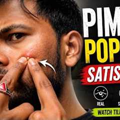 pimple popping satisfying