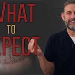 Your Hair Transplant Results Month by Month — The Full 12-Month Timeline