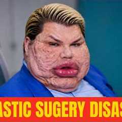 15 Celebrities Before and After Plastic Surgery | Then and Now 2026