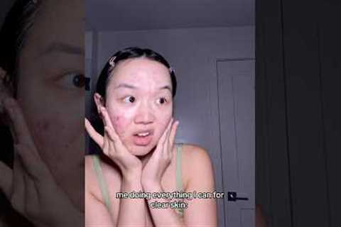 Their skin is built different 🫡✨ #viral  #relatable #skincare #acne #shorts