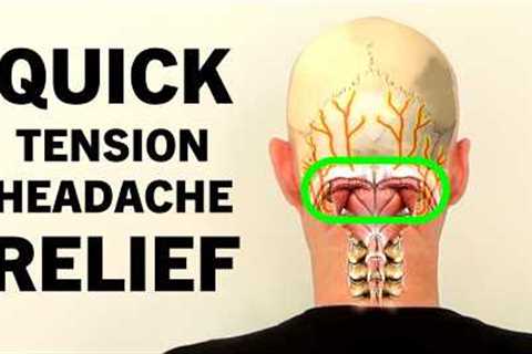 Tension Headache Exercises. Stress Headache Relief in 4 Minutes.