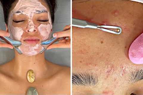 ACNE NO Talking SPA-ASMR Facial {Pimple Popping!!!}