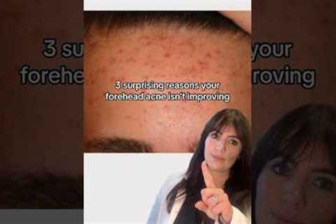4 reasons why your forehead acne isn’t improving👆🏽 #acne #acnehelp #acneproneskin #acnetreatment