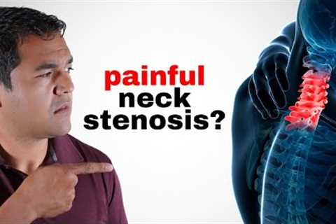 10 Things You Should AVOID if You Have Neck Cervical Stenosis