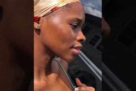 Skin transformation. How I cleared my acne & hyperpigmentation  - full video on my channel