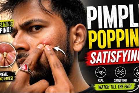 pimple popping satisfying